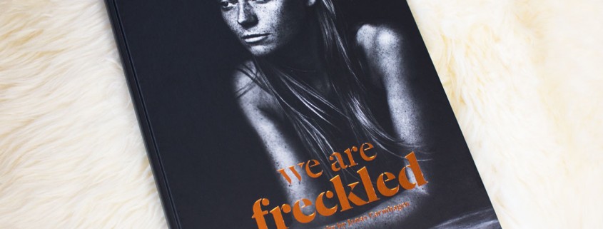 we are freckled
